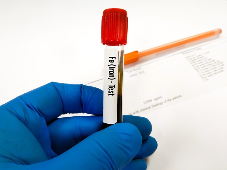 A gloved hand holds a blood collection tube labeled "Fe (Iron) Test" in front of a blurred medical document.